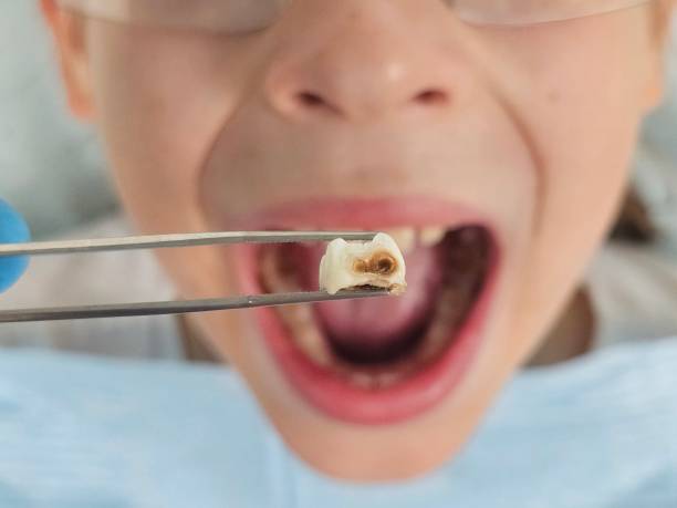 Best Pediatric Emergency Dentist in Lowellville, OH